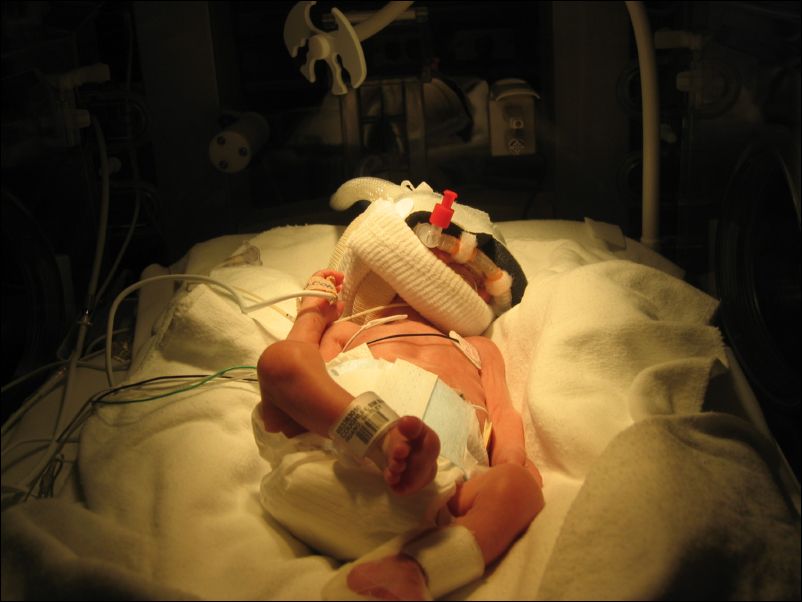 Sebastian not excited about CPAP